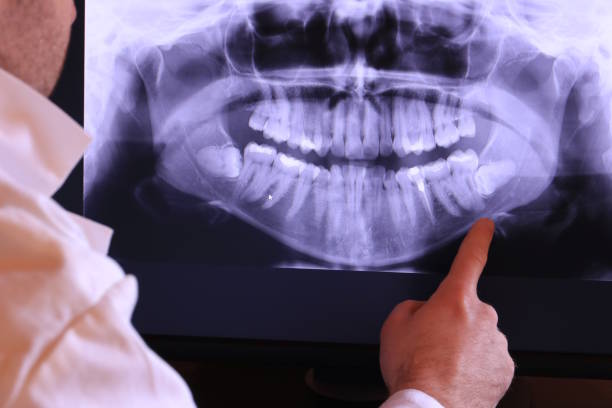 Best Emergency Dental Extractions in Noank, CT